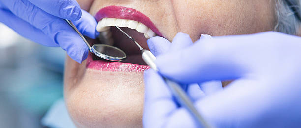 Best Broken or Chipped Tooth Repair in East Lansdowne, PA